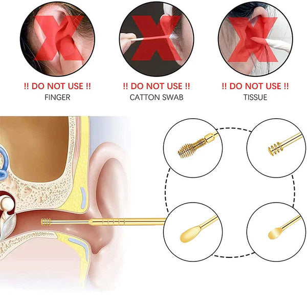 Ear Wax Cleaner Tool Kit – Set Of 6 Pieces Al Hassan Store
